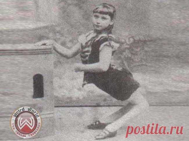 Трудно поверить, но эти 5 человек с аномалиями действительно существовали! Их истории невероятны...