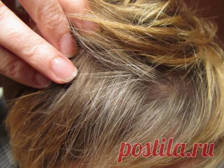 Народные средства против вшей.
Педикулез – это заболевание, при котором на волосяных участках кожи селятся вши. Насекомые подпитываются кровью человека, а их слюна является опасной из-за того, что она токсична и может служить разносчиком инфекций таких, как тиф и волынская лихорадка.