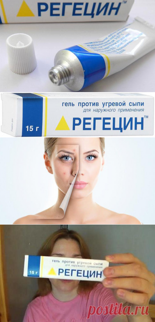 Гель "Регецин" от морщин: отзывы косметологов, особенности применения и эффективность