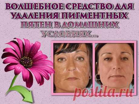 (43) Одноклассники