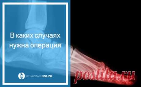 Перелом пальца на ноге симптомы - лечение