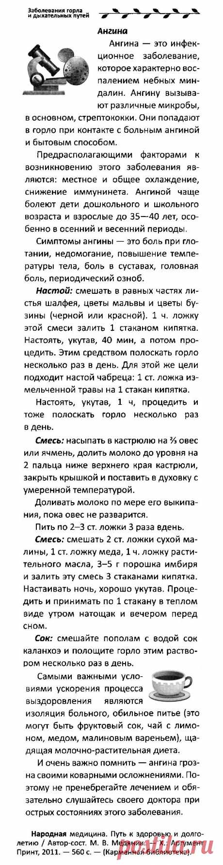 Ангина