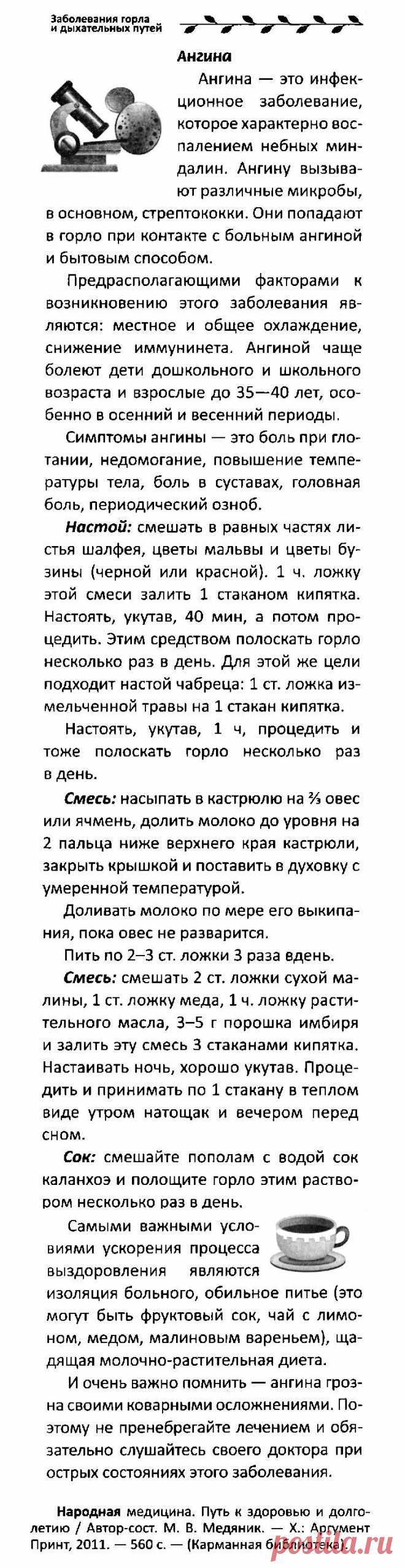 Ангина
