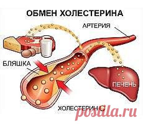 Высокий уровень холестерина | WelleW.
Большинство людей не думают о высоком уровне холестерина как о форме сердечно-сосудистого заболевания, но в действительности, это серьезное состояние, которое создает основу для повреждения артерий, что приводит к инфаркту, инсульту и другим видам сердечно-сосудистых заболеваний