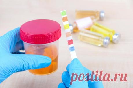 Тревожные симптомы, при которых нужно срочно отвести ребенка к урологу Если по отношению к собственному здоровью некоторые из нас позволяют себе такие вольности, как не явиться на плановый осмотр или прийти к врачу тогда, когда терпеть больше нет сил, то со здоровьем ребенка нужно держать ухо востро.