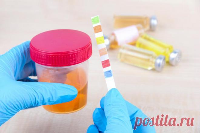 Тревожные симптомы, при которых нужно срочно отвести ребенка к урологу Если по отношению к собственному здоровью некоторые из нас позволяют себе такие вольности, как не явиться на плановый осмотр или прийти к врачу тогда, когда терпеть больше нет сил, то со здоровьем ребенка нужно держать ухо востро.