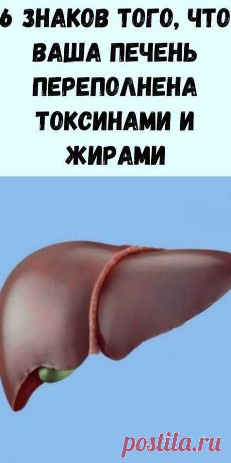 Врачи назвали симптомы, которые указывают, что с печенью беда 6 знаков того, что ваша печень переполнена токсинами и жирами (и как избавиться от этого)
