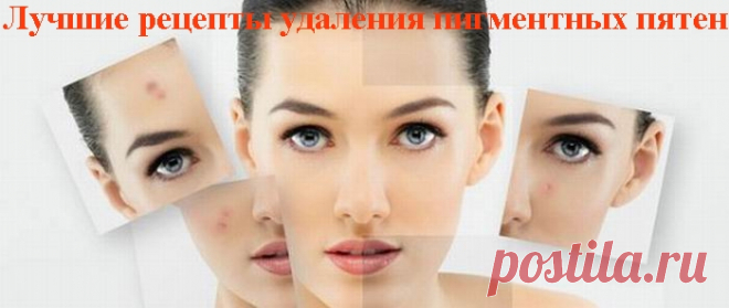Лучшие рецепты удаления пигментных пятен