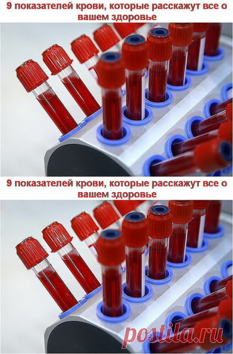 Показатели крови