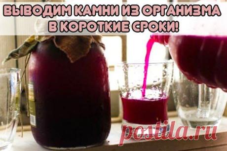 Всё самое интересное!: ВЫВОДИМ КАМНИ ИЗ ОРГАНИЗМА В КОРОТКИЕ СРОКИ!