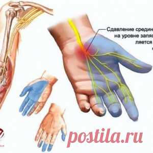 НАРОДНЫЕ СРЕДСТВА ПРОТИВ ОНЕМЕНИЯ РУК И НОГ - МирТесен