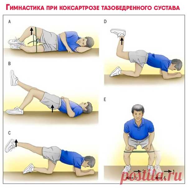 4+ простых и эффективных упражнений при коксартрозе тазобедренных суставов

Знали ли вы, что диагноз коксартроз (артроз) тазобедренного сустава ставят одному из десяти пациентов возрастом после 40 лет, после 60 лет — одному из трех пациентов, а у тех, кому за 70, коксартроз выявляется в 80% случаев?

ЛФК считается основой успешного лечения артроза: регулярное выполнение упражнений укрепляет связки и мышцы вокруг больного сустава, что снижает дискомфорт при привычных ежедне...