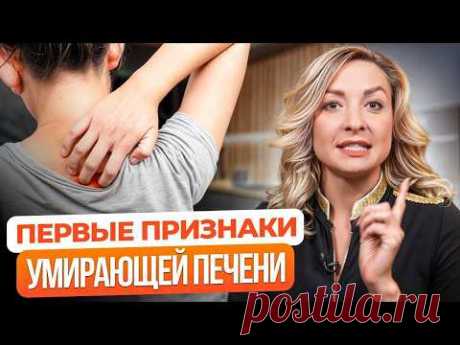 5 ПРИЗНАКОВ, что ваша печень БОЛЬНА! / Почему болит печень на самом деле?