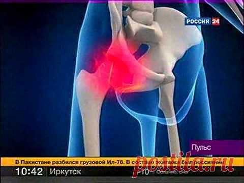 Подагра, лечение народными средствами | Рецепты народной медицины