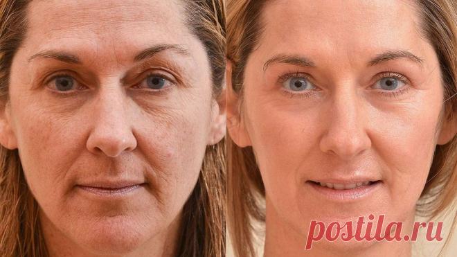 5 омолаживающих средств до 600 рублей, которые работают не хуже ботокса🔥 | Кореянка в России... Уже давно самым эффективным способом омоложения считают ботокс. Но не каждая девушка решится на него. И я не исключение. Сегодня хочу поделиться средствами, эффект от которых при регулярном...