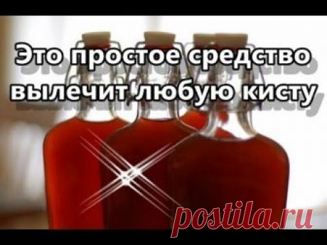 Это простое средство вылечит любую кисту