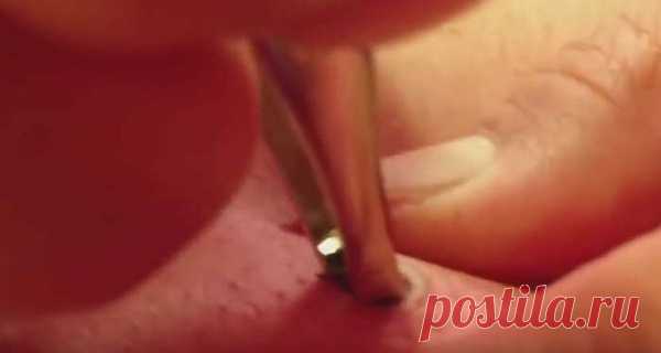 CUANDO APARECIÓ UNA MANCHA NEGRA EN SU CUERPO FUE DIRECTAMENTE AL MÉDICO Y LUEGO LO INDISCIBLE SIGUE &#8211; Hoy En Belleza