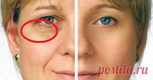 Узнай, какие ингредиенты нужно смешивать для маски от мимических морщин. 4 суперрецепта!