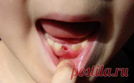 В каком порядке происхдит смена молочных зубов?