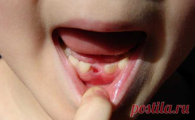 В каком порядке происхдит смена молочных зубов?