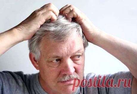 Почему чешется голова - причины, лечение зуда кожи головы