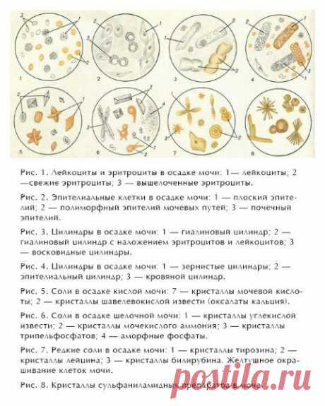 #КСлаборатория
ОБЩИЙ АНАЛИЗ МОЧИ КОШЕК: ИНТЕРПРЕТАЦИЯ РЕЗУЛЬТАТОВ
Источник: Будни ветеринара 

Ветврач, каким бы он не был профессионалом, не обладает рентгеновским зрением и экстрасенсорными способностями, поэтому для постановки диагноза на то или иное заболевание ему необходимо иметь на руках результаты лабораторных исследований. Одним из таких помощников будет общий анализ мочи кошки — простой метод, который позволяет оценить не только состояние мочевыделительной систем...