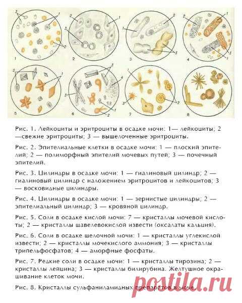 #КСлаборатория
ОБЩИЙ АНАЛИЗ МОЧИ КОШЕК: ИНТЕРПРЕТАЦИЯ РЕЗУЛЬТАТОВ
Источник: Будни ветеринара 

Ветврач, каким бы он не был профессионалом, не обладает рентгеновским зрением и экстрасенсорными способностями, поэтому для постановки диагноза на то или иное заболевание ему необходимо иметь на руках результаты лабораторных исследований. Одним из таких помощников будет общий анализ мочи кошки — простой метод, который позволяет оценить не только состояние мочевыделительной систем...