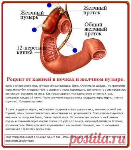 Рецепт от камней в почках и желчном пузыре