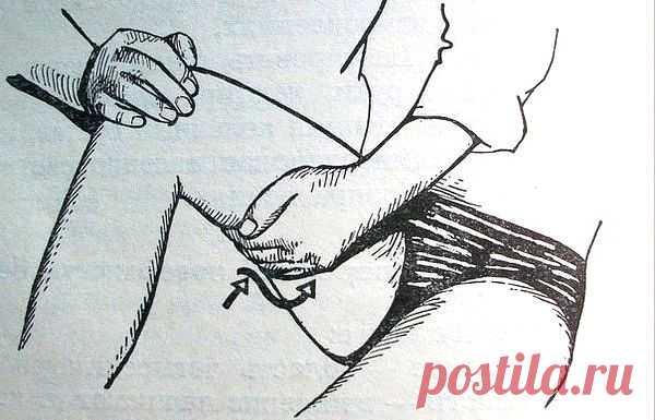 Внутренняя сторона бедра - зона достаточно проблемная.