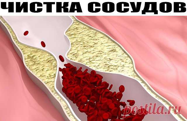 ЧИСТКА СОСУДОВ
У моей мамы после 50 лет стали иногда неметь пальцы рук и ног. Приятельница, медсестра подсказала, что это связано с сосудами. И научила, как за ними следить.
Курс лечения такой:
Вечером нужно взять 1/3 стакана семян льна, залить 1 л воды, довести до кипения и 2 часа выдержать на водяной бане. За ночь отвар должен настояться, а утром его следует процедить. Должно получиться примерно примерно 850 мл киселеподобной жидкости. Ее нужно выпить за 5 дней: по 1/3 с...
