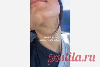 В сети восхитились внешностью блогерши с волосами на подбородке