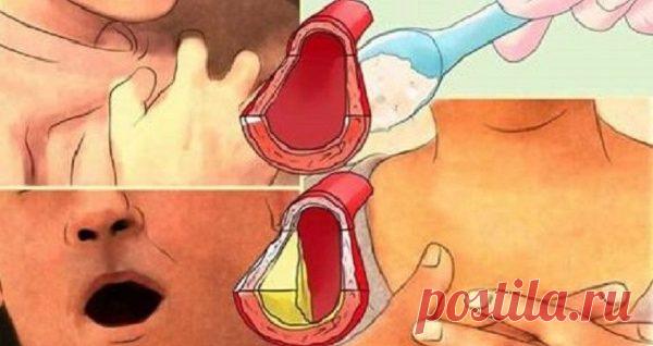 Мой кардиолог прочистил мои артерии и снял высокое артериальное давление с помощью всего 4 столовых ложек этого средства! Питательная бомба, которая творит чудеса! Естественная медицина стала действительно альтернативой в современном мире. Многие люди используют эти средства,