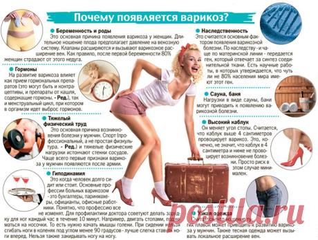 Варикоз: причины, симптомы, лечение, профилактика, осложнения