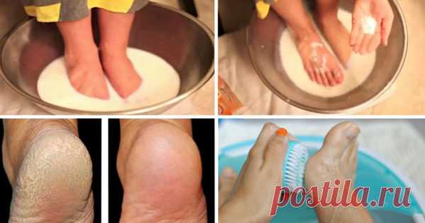 Хватит тратить деньги на педикюр: эти 2 простых продукта сделают твои ножки идеальными! 
КРАСОТА ЛАЙФХАКИ ЛЕТО МОЛОКО НОГИ ПЯТКИ СОДА 
Согласись, огрубевшие и шершавые пятки своим видом могут испортить впечатление даже о самой симпатичной женщине. 

Рецепт средства для пяток, которое в кратчайшие сроки сделает их мягкими и нежными, как у младенца. 
Показать полностью…