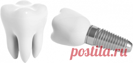 Имплантация зубов в Краснодаре в клинике BOSS_SMILE