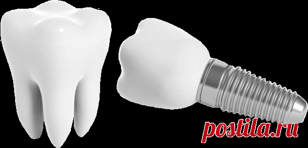 Имплантация зубов в Краснодаре в клинике BOSS_SMILE