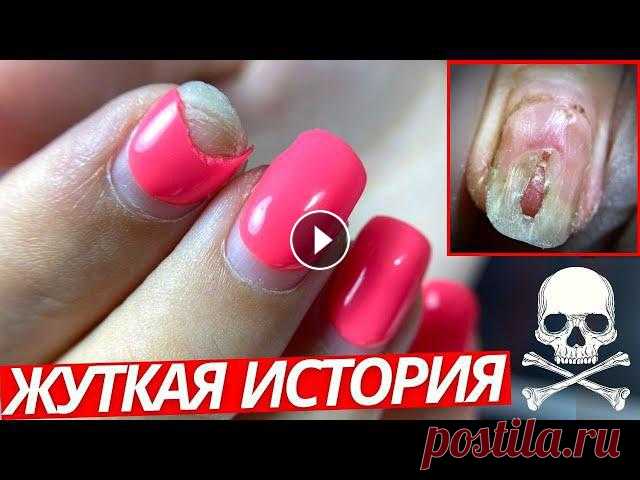 ЗНАЙТЕ ЭТО! Жуткая история маникюра. Гель лак и дизайн ногтей стразами 2022 Пол ночи не могла уснуть когда узнала эту жуткую историю маникюра. Это необходимо знать каждому мастеру маникюра и их клиентам! Такие ногти покрывать ...