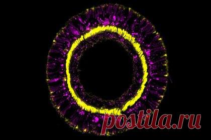 У морских анемонов обнаружили гены молодости. Ученые Венского университета обнаружили гены, которые наделяют нервную систему морских анемонов вечной «молодостью». У Nematostella vectensis существуют генетические механизмы с участием гена SoxC, которые позволяют заменять отсутствующие нейроны и сохранять молодость нервной системы.