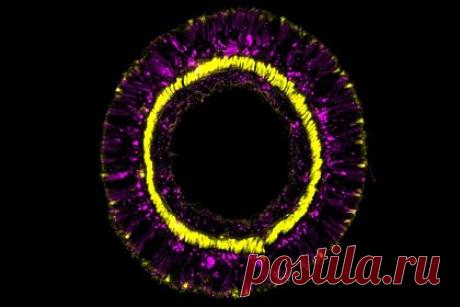 У морских анемонов обнаружили гены молодости. Ученые Венского университета обнаружили гены, которые наделяют нервную систему морских анемонов вечной «молодостью». У Nematostella vectensis существуют генетические механизмы с участием гена SoxC, которые позволяют заменять отсутствующие нейроны и сохранять молодость нервной системы.