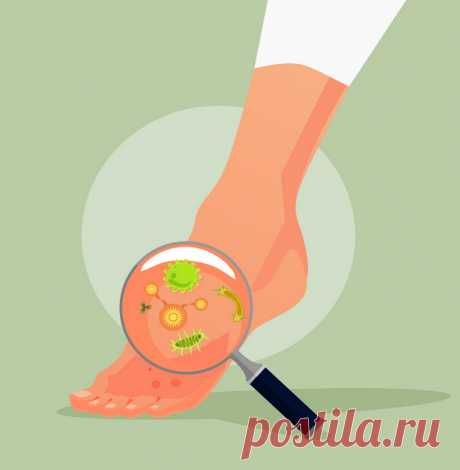 Грибок: Как лечить снаружи и изнутри