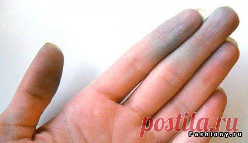 Как очистить кожу от зеленки