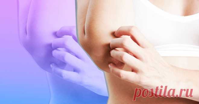 Псориаз как он есть: причины заболевания и методы лечения | SUPER.UA Эффективные методы лечения симптомов псориаза. Псориаз – это серьезное заболевание, с которым может столкнуться каждый из нас.