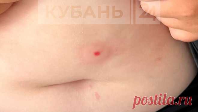 Российский школьник получил пули в живот и бедро на прогулке. В Сочи прогулка с друзьями закончилась для второклассника обращением за медицинской помощью - мальчик получил несколько пуль от неизвестного. Об этом сообщает "Кубань 24" в Telegram-канале. Инцидент произошел на скейт-площадке, ...