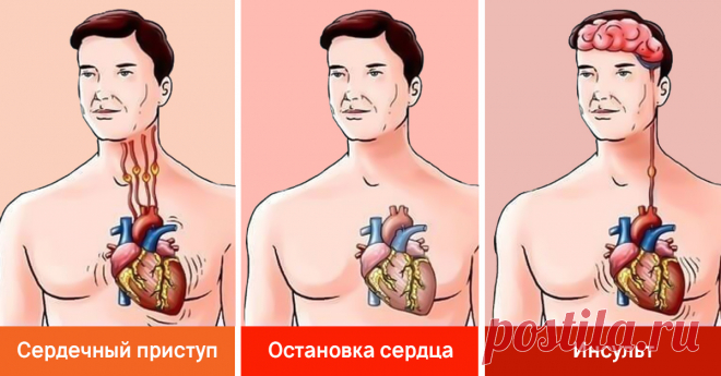 Парамедик разложил по полочкам: «Ты научишься оказывать первую помощь не хуже, чем я!» Теперь не вздрогну в критической ситуации.