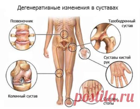 Как принимать желатин для суставов? | ВСЕГДА В ФОРМЕ!