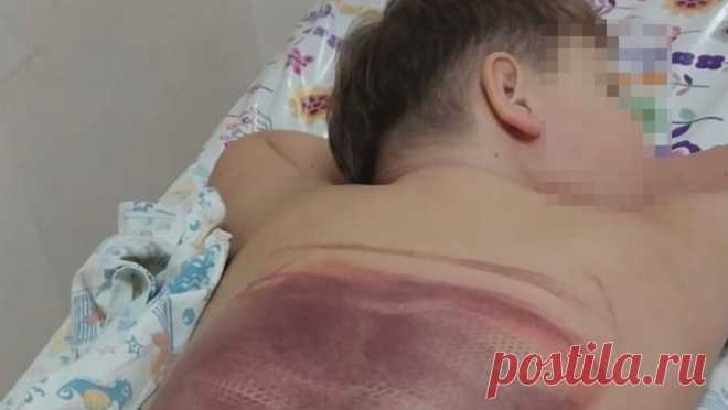 Ребенка затянуло в систему фильтрации в бассейне аквапарка. В рязанском аквапарке "Окская жемчужина" мальчика затянуло в систему фильтрации в детском бассейне. Об этом сообщила мать пострадавшего в группе "Типичная Рязань" во "ВКонтакте". По словам матери мальчика, ...