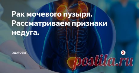 Рак мочевого пузыря. Рассматриваем признаки недуга. Его не зря называют "болезнью пожилых", ведь он чаще всего затрагивает людей старше 65 лет.