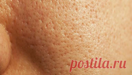 Советы по уменьшению больших пор
Натуральные жиры используют поры в качестве шлюзов для достижения верхнего слоя кожи для обеспечения влаги. Однако, когда они увеличены, многие испытывают дискомфорт. Поры могут быть очень заметны, когда они забиты или раздражены, и особенно среди людей, имеющих дело с жирной кожей. Таким образом, сегодня мы даем вам некоторые естественные советы, чтобы уменьшить поры легко и […]
Читай дальше на сайте. Жми подробнее ➡