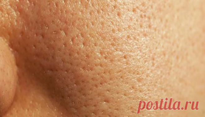 Советы по уменьшению больших пор
Натуральные жиры используют поры в качестве шлюзов для достижения верхнего слоя кожи для обеспечения влаги. Однако, когда они увеличены, многие испытывают дискомфорт. Поры могут быть очень заметны, когда они забиты или раздражены, и особенно среди людей, имеющих дело с жирной кожей. Таким образом, сегодня мы даем вам некоторые естественные советы, чтобы уменьшить поры легко и […]
Читай дальше на сайте. Жми подробнее ➡