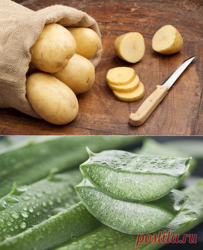 6 просто волшебных средств, которые помогут уменьшить растяжки